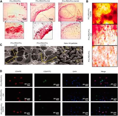 Drug delivery systems based on polyethylene glycol hydrogels for enhanced bone regeneration